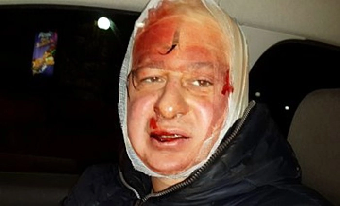New York Times, AFP photographers among at least 40 journalists injured in attacks by police (UPDATE)