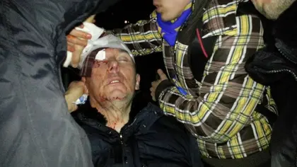 Lutsenko hospitalized as authorities face political fallout (VIDEO, UPDATE)