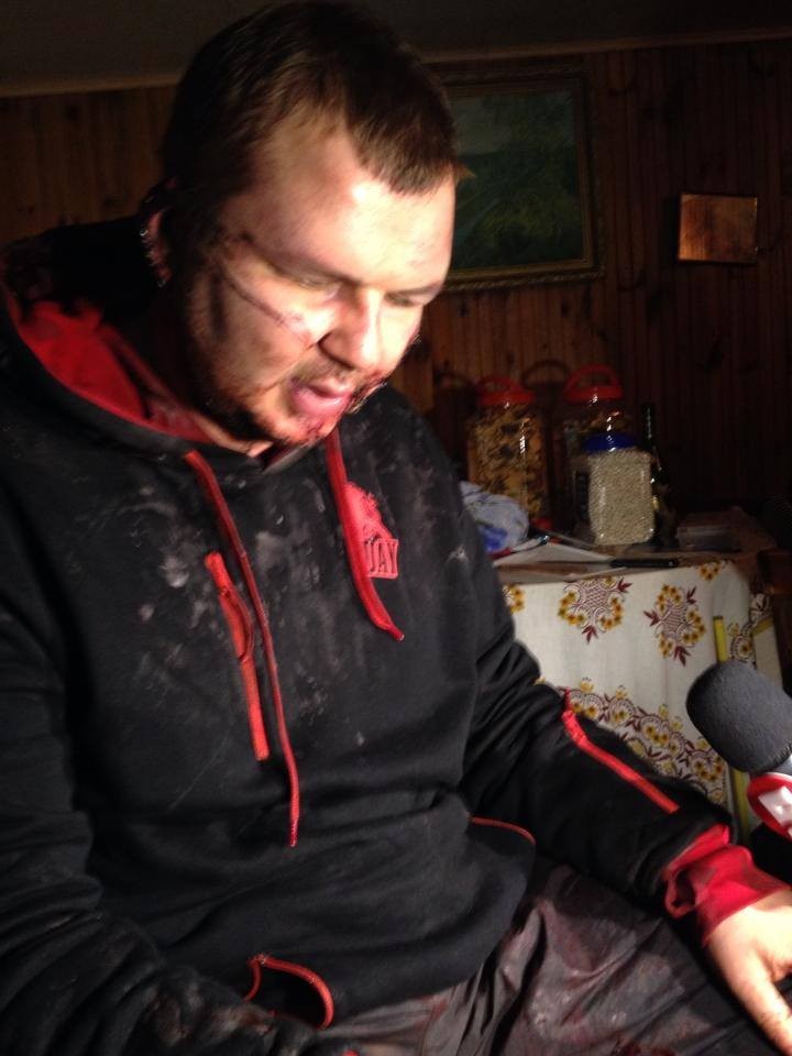AutoMaidan leader Bulatov found alive eight days after disappearance (UPDATE) (PHOTOS, VIDEO)