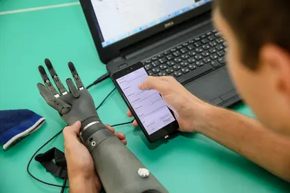 Ukrainian startup Esper Bionics develops smart hand prostheses