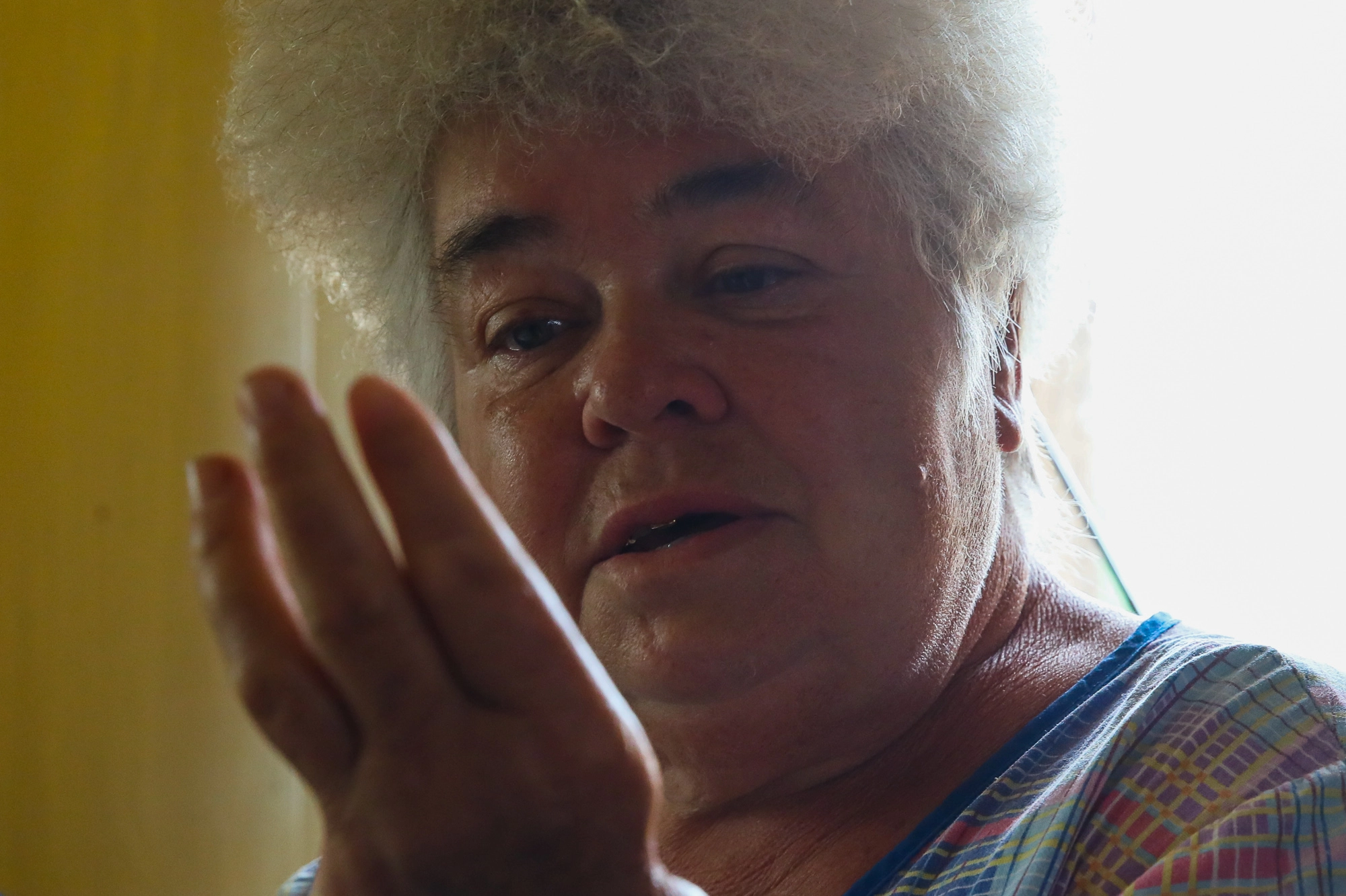 Anna Goncharova, a local civilian, looks at her hand stripped of thumb and little finger after an injury sustained in a Grad missile attack in the town of Opytne, pictured on June 12, 2019.