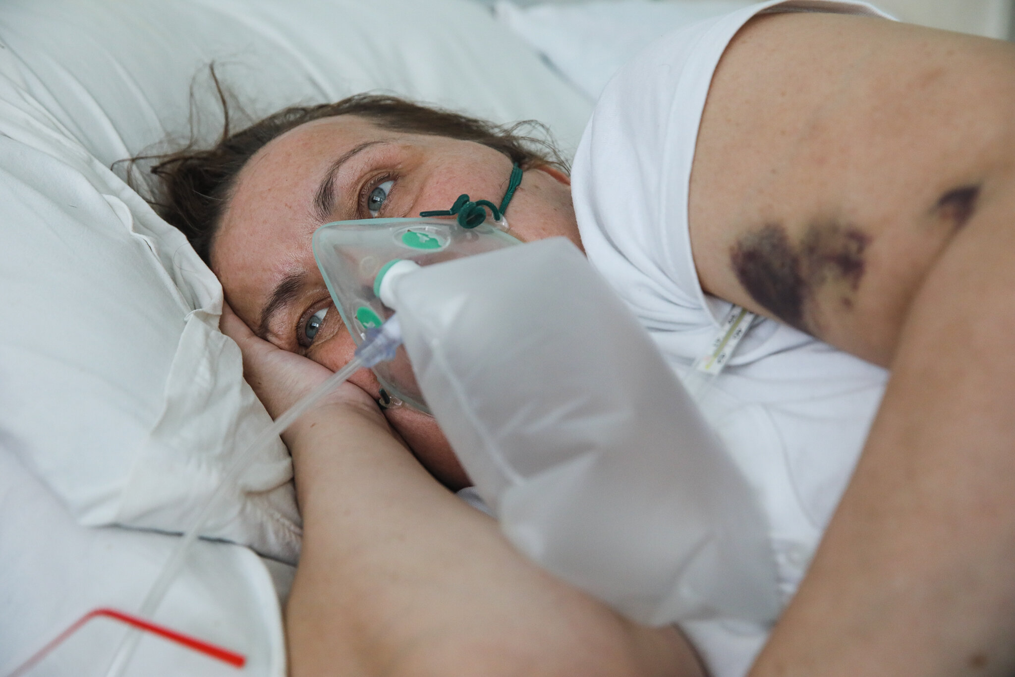 A patient wears an oxygen mask at Kolomyia District Hospital in Ivano-Frankivsk Oblast on March 16, 2021.