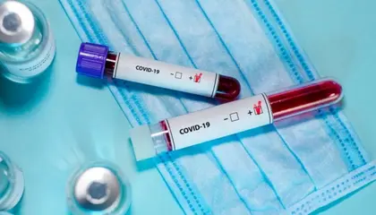 COVID-вакцини зберегли життя понад 1,4 млн людей у Європі - ВООЗ
