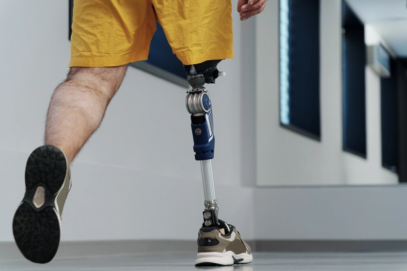 “YE-PROTEZ” changes the lives of Ukrainians: Andrii Matiukha Foundation supported an innovative hub for people with amputations