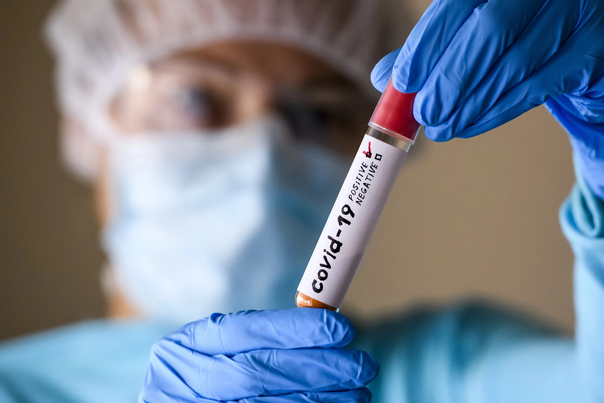 COVID-19 як сезонне захворювання: чи готова Україна до осінньо-зимового спалаху?
